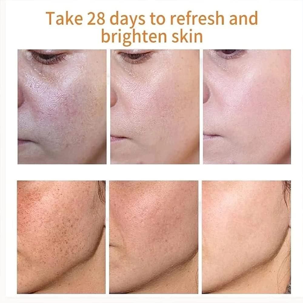 Japanese Melasma Cream